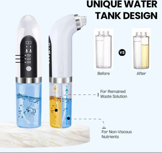 Bubble Facial & Blackhead Remover – Deep Cleanser